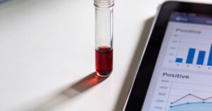 Test ciążowy z krwi: kiedy warto go wykonać i jak odczytać wynik?