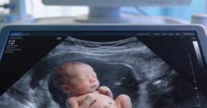 Przezierność karkowa: co oznacza to badanie i dlaczego warto je wykonać?